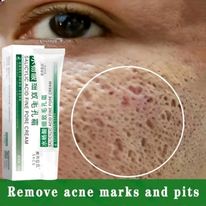 Salicylic Acid Pore Clearing C – обзор и цена Azelaic Acid Cream