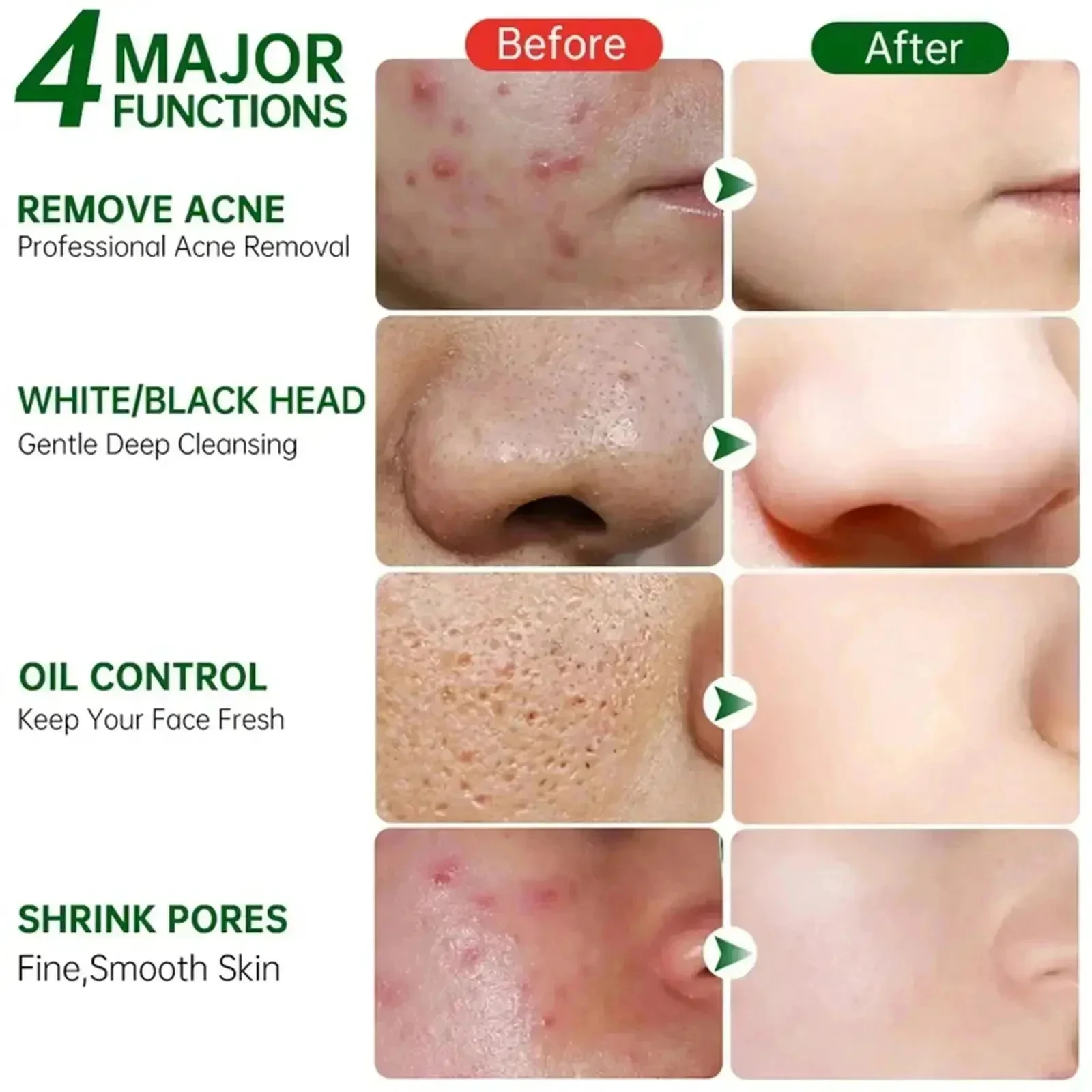 Salicylic Acid Pore Clearing C – обзор и цена Azelaic Acid Cream