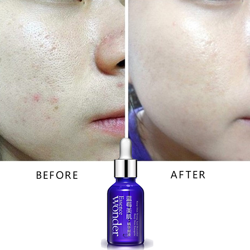BIOAQUA Blueberry Face Lifting – обзор и цена Skincare Bioaqua
