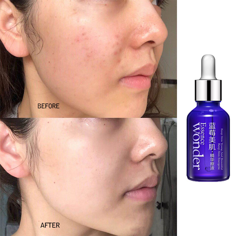 BIOAQUA Blueberry Face Lifting – обзор и цена Skincare Bioaqua