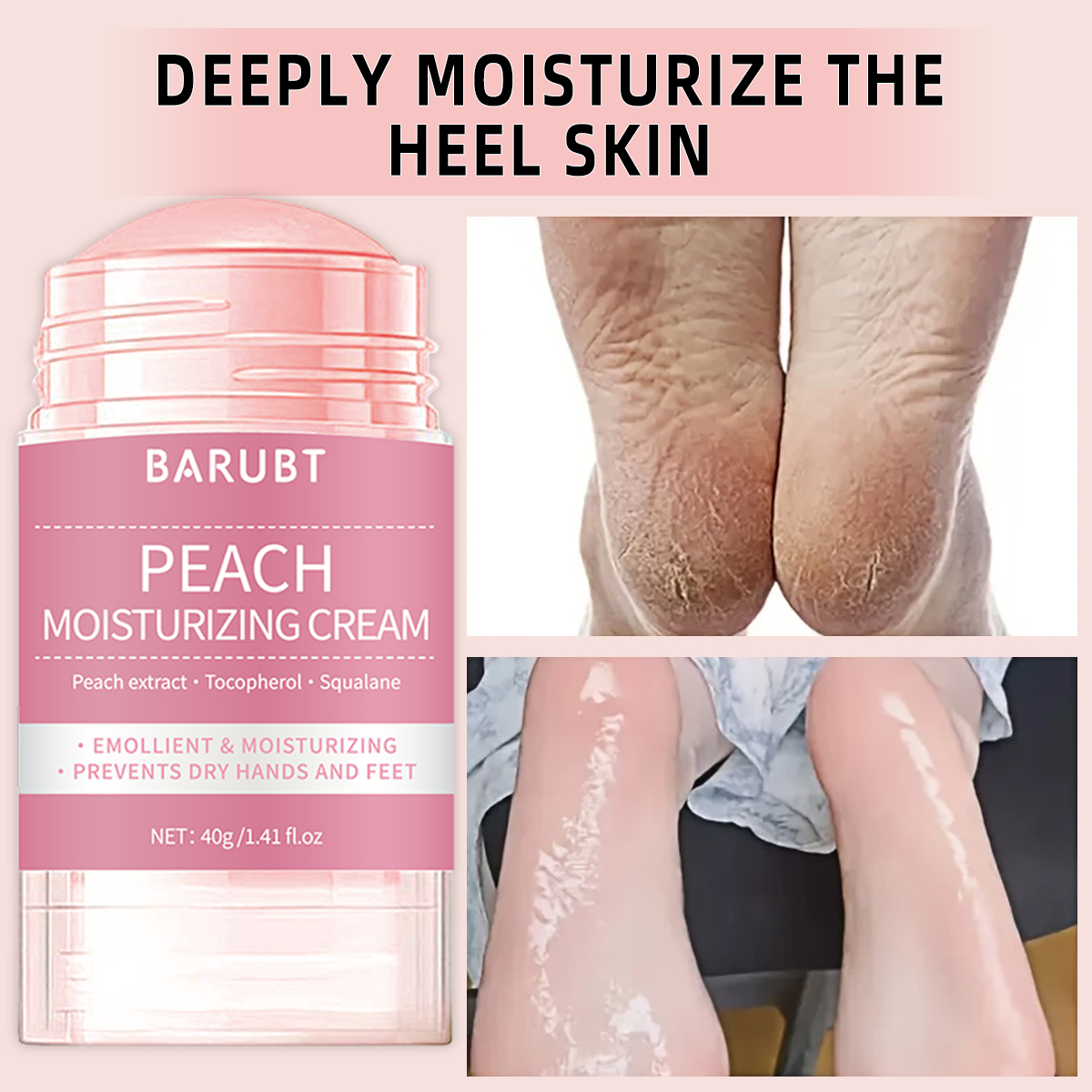 Peach urea mud film rod, salic – обзор и цена Azelaic Acid Cream