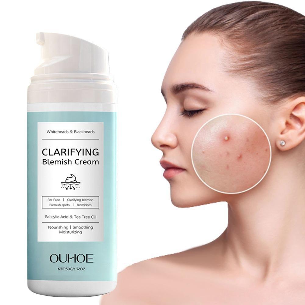 Salicylic Acid Facial Cream fo – обзор и цена Azelaic Acid Cream