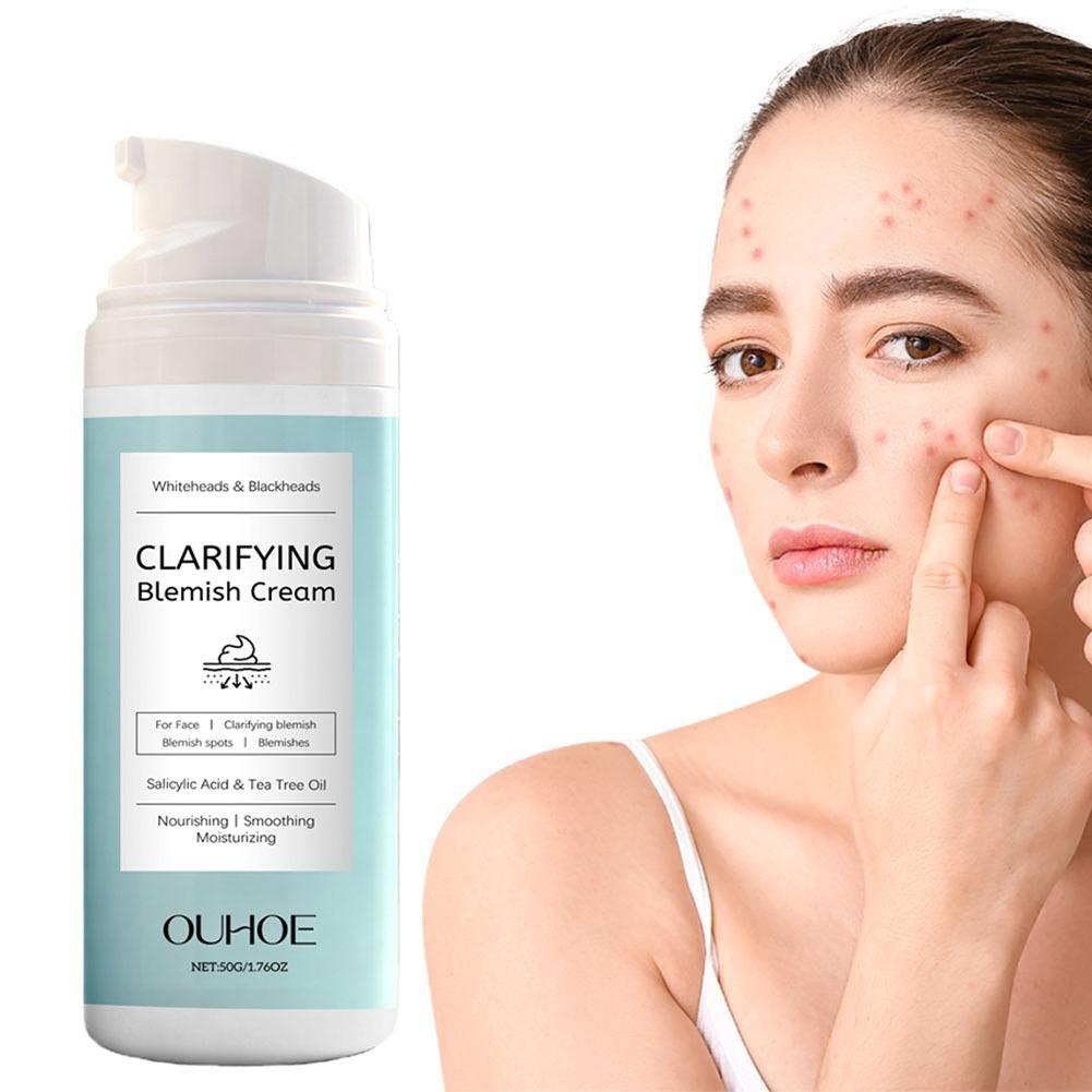 Salicylic Acid Facial Cream fo – обзор и цена Azelaic Acid Cream