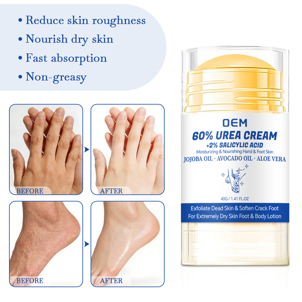 60% Urea Foot Cream + 2% Salic – обзор и цена Azelaic Acid Cream