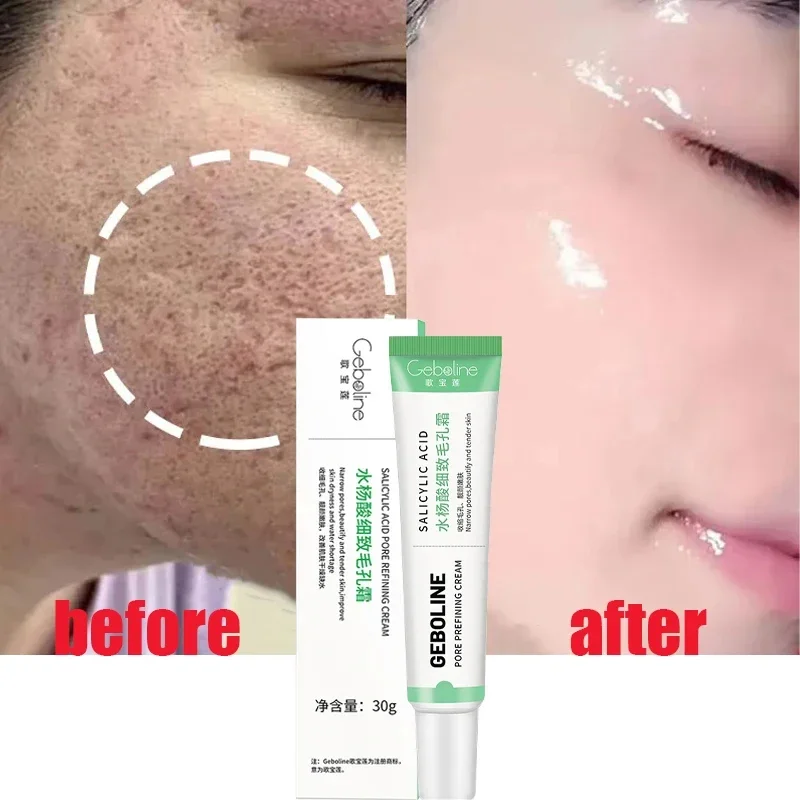 Salicylic Acid Pore Shrinking  – обзор и цена Azelaic Acid Cream