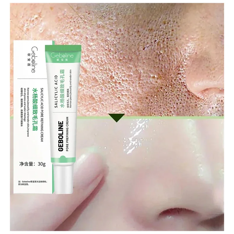 Salicylic Acid Pore Shrinking  – обзор и цена Azelaic Acid Cream