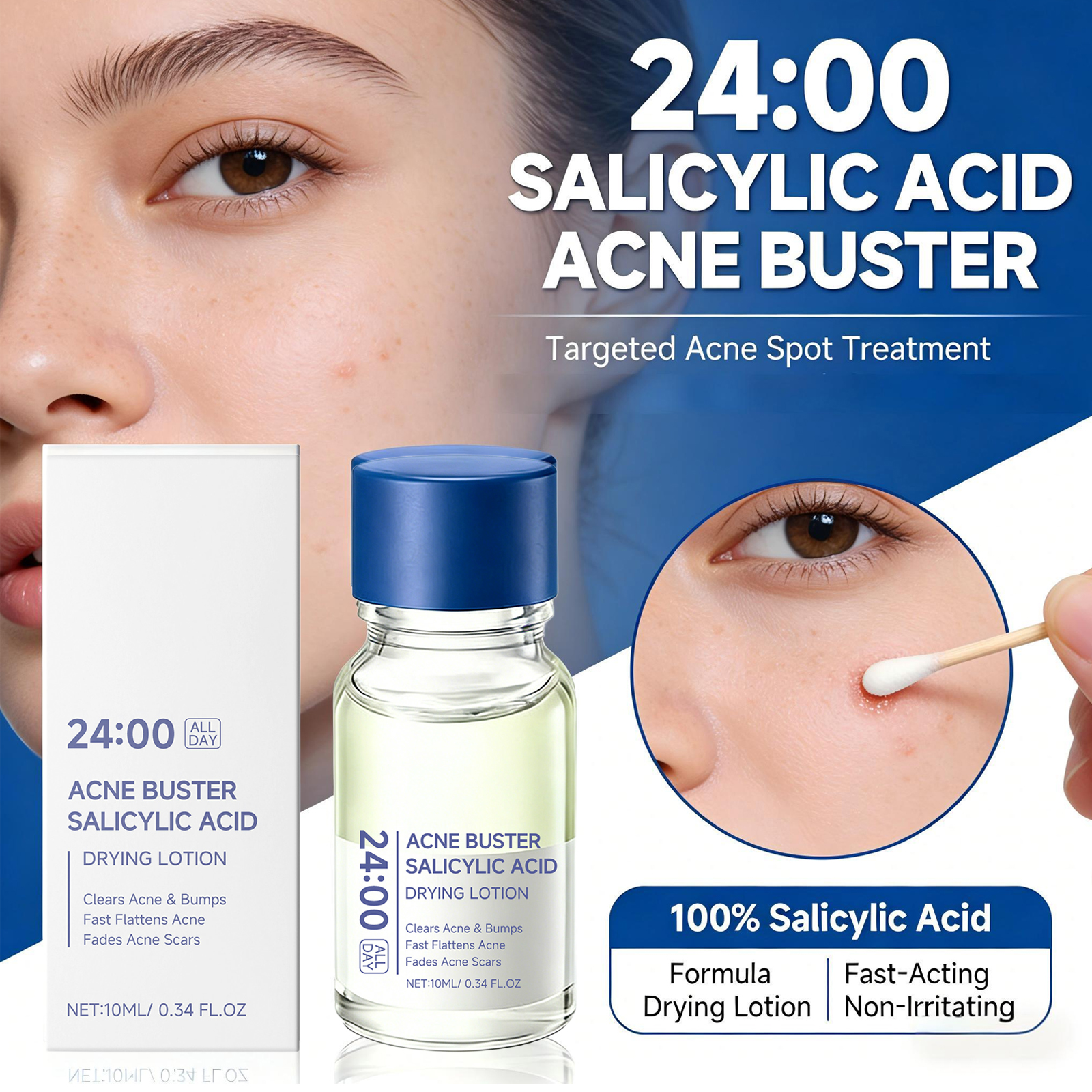 Salicylic Acid Drying Lotion F – обзор и цена Azelaic Acid Cream